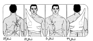 باند سه گوش برای پشت و سینه